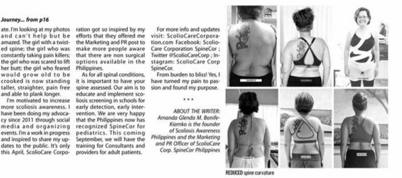 Scoliosis Journey Page 2