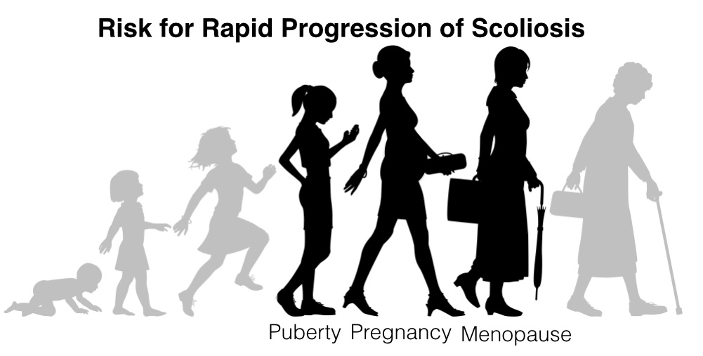 Risky Times for Scoliosis Progression - Puberty, Pregnancy and Menopause 2