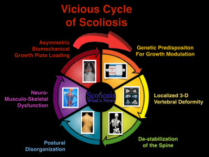 Vicious Cycle of Scoliosis