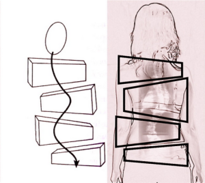 Schroth's Body Block Concept of Scoliosis